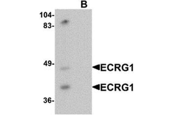 anti-Transmembrane Protease, Serine 11A (TMPRSS11A) (C-Term) antibody