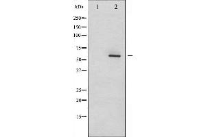 Image no. 3 for anti-Disabled Homolog 1 (Drosophila) (DAB1) (pTyr232) antibody (ABIN6256680)