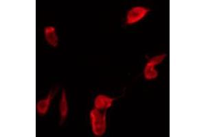 Image no. 3 for anti-Insulin Receptor Substrate 1 (IRS1) (pSer307) antibody (ABIN6255185)