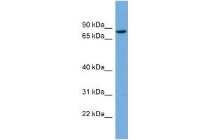 Image no. 1 for anti-Cartilage Acidic Protein 1 (CRTAC1) (N-Term) antibody (ABIN2787063)