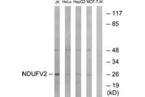 Image no. 1 for anti-NADH Dehydrogenase (Ubiquinone) Flavoprotein 2, 24kDa (NDUFV2) (AA 20-69) antibody (ABIN1535063)