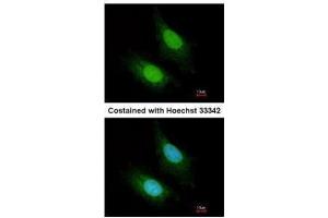 Image no. 2 for anti-Zinc Finger CCCH-Type Containing 12A (ZC3H12A) (Center) antibody (ABIN2856778)