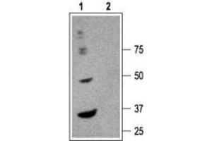 GABRA6 antibody  (Extracellular, N-Term)