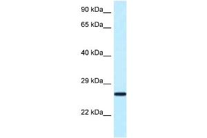 Image no. 1 for anti-Nudix (Nucleoside Diphosphate Linked Moiety X)-Type Motif 16 (NUDT16) (N-Term) antibody (ABIN2785160)