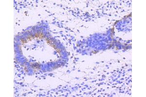 Image no. 5 for anti-SMAD, Mothers Against DPP Homolog 2 (SMAD2) (pThr183), (pThr221) antibody (ABIN3061343)