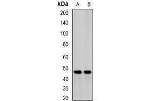 Image no. 2 for anti-Jumonji Domain Containing 6 (JMJD6) antibody (ABIN2966753)