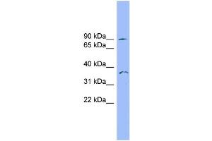 WB Suggested Anti-SDCCAG8 Antibody Titration: 0.