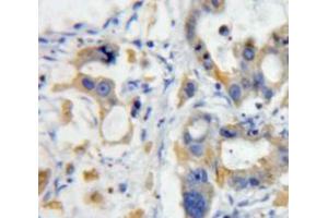 Image no. 3 for anti-Tumor Necrosis Factor (Ligand) Superfamily, Member 12 (TNFSF12) (AA 53-249) antibody (ABIN5014474)