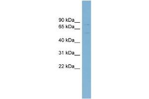 Image no. 1 for anti-ATP-Binding Cassette, Sub-Family G (WHITE), Member 5 (ABCG5) (Middle Region) antibody (ABIN2781532)