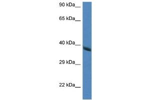 Image no. 2 for anti-Hydroxyacid Oxidase 2 (HAO2) (Middle Region) antibody (ABIN2776811)