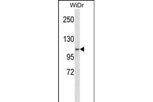 ZNF836 抗体  (N-Term)