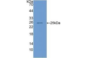 Image no. 5 for Cartilage Oligomeric Matrix Protein (COMP) ELISA Kit (ABIN6720567)