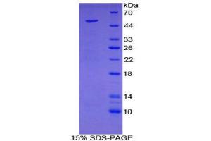 Image no. 1 for Secretogranin II (SCG2) (AA 11-187) protein (His tag,GST tag) (ABIN1879880)