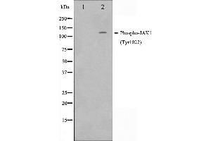 Image no. 10 for anti-Janus Kinase 1 (JAK1) (pTyr1022), (pTyr1023) antibody (ABIN6255762)