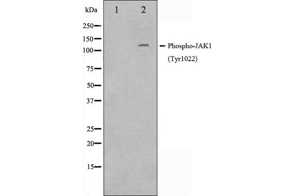 JAK1 Antikörper  (pTyr1022, pTyr1023)