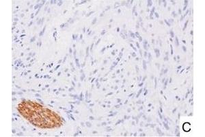 Image no. 12 for anti-L1 Cell Adhesion Molecule (L1CAM) (AA 1-1120) antibody (ABIN1995799)