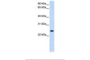 Image no. 2 for anti-Progesterone Receptor Membrane Component 1 (PGRMC1) (N-Term) antibody (ABIN6738268)