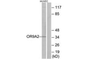 Image no. 1 for anti-Olfactory Receptor, Family 9, Subfamily A, Member 2 (OR9A2) (AA 260-309) antibody (ABIN1535968)