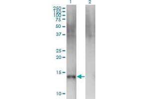 Image no. 2 for anti-Sema Domain, Immunoglobulin Domain (Ig), Transmembrane Domain (TM) and Short Cytoplasmic Domain, (Semaphorin) 4B (SEMA4B) (AA 592-689) antibody (ABIN523913)