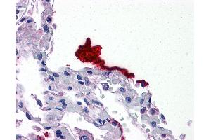 Image no. 1 for anti-Kallikrein 6 (KLK6) (AA 74-123) antibody (ABIN6746999)