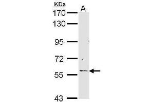 Image no. 1 for anti-Regulator of Chromosome Condensation (RCC1) and BTB (POZ) Domain Containing Protein 2 (RCBTB2) (Center) antibody (ABIN2856868)