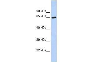 Image no. 1 for anti-TAF6-Like RNA Polymerase II, P300/CBP-Associated Factor (PCAF)-Associated Factor, 65kDa (TAF6L) (C-Term) antibody (ABIN2780781)