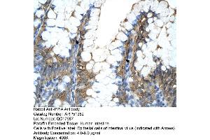 Image no. 2 for anti-Peptidylprolyl Isomerase A (Cyclophilin A) (PPIA) (Middle Region) antibody (ABIN2784530)
