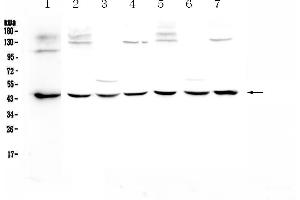 Image no. 1 for anti-WW Domain Containing Oxidoreductase (WWOX) (AA 1-245) antibody (ABIN5693294)