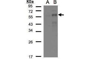 Image no. 1 for anti-Early Growth Response 2 (EGR2) (Center) antibody (ABIN2855514)