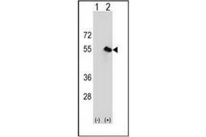 Image no. 2 for anti-Carboxypeptidase N Subunit 1 (CPN1) (AA 209-240), (Middle Region) antibody (ABIN951036)