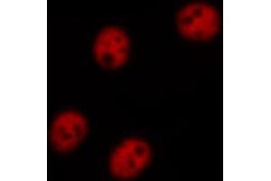 Image no. 2 for anti-NF-kappa-B inhibitor beta (NFKBIB) (pSer23) antibody (ABIN6256201)