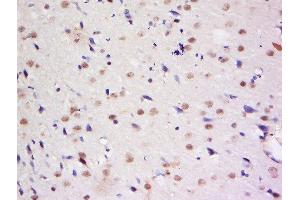 Dymeclin antibody  (AA 151-250)