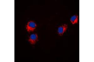 Image no. 1 for anti-Paxillin (PXN) (N-Term) antibody (ABIN2707694)