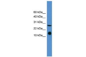 Image no. 1 for anti-Interleukin 5 (IL5) (Middle Region) antibody (ABIN2785670)