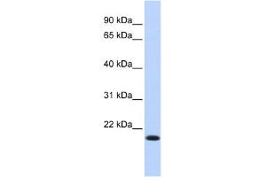 Image no. 1 for anti-Interferon Regulatory Factor 7 (IRF7) (N-Term) antibody (ABIN2780566)