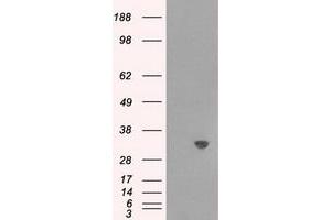 Image no. 5 for anti-Thiopurine S-Methyltransferase (TPMT) antibody (ABIN1501480)