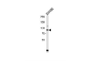 Image no. 8 for anti-Proprotein Convertase Subtilisin/kexin Type 9 (PCSK9) (AA 153-183), (N-Term) antibody (ABIN652320)