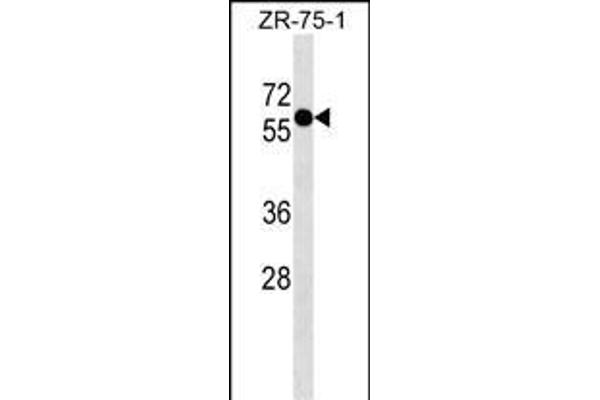ZNF503 antibody  (N-Term)