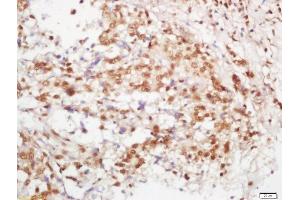 Image no. 2 for anti-V-Myb Myeloblastosis Viral Oncogene Homolog (Avian)-Like 2 (MYBL2) antibody (ABIN760406)