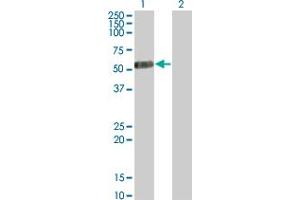 Image no. 2 for anti-Interleukin 13 Receptor, alpha 2 (IL13RA2) (AA 27-126) antibody (ABIN561476)