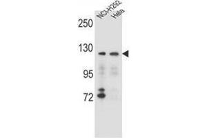 Image no. 1 for anti-Sorting Nexin 13 (SNX13) (AA 779-807), (C-Term) antibody (ABIN954885)