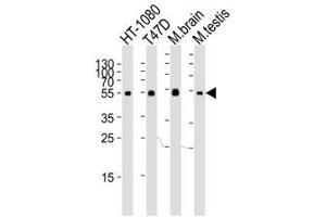 Image no. 3 for anti-Tubulin, alpha 1c (TUBA1C) (N-Term) antibody (ABIN3029335)