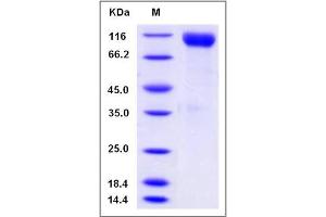 Image no. 1 for CUB Domain Containing Protein 1 (CDCP1) (AA 1-666) protein (His tag) (ABIN2008630)