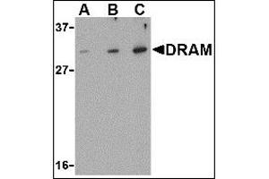 Image no. 2 for anti-DNA-Damage Regulated Autophagy Modulator 1 (DRAM1) (N-Term) antibody (ABIN372925)