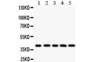 Image no. 5 for anti-Major Histocompatibility Complex Class I C (HLA-C) (AA 38-62), (C-Term) antibody (ABIN3043843)