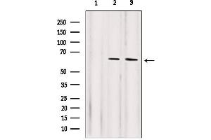 Image no. 6 for anti-Nuclear Factor-kB p65 (NFkBP65) antibody (ABIN6263616)