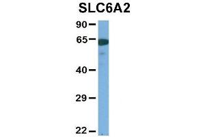 Image no. 3 for anti-Solute Carrier Family 6 (Neurotransmitter Transporter, Noradrenalin), Member 2 (SLC6A2) (Middle Region) antibody (ABIN2777051)