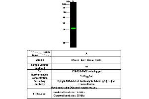 Image no. 1 for anti-Sclerostin Domain Containing 1 (SOSTDC1) (C-Term) antibody (ABIN6924069)