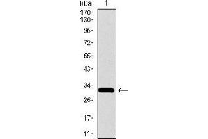 Image no. 3 for anti-Solute Carrier Family 27 (Fatty Acid Transporter), Member 5 (SLC27A5) (AA 508-570) antibody (ABIN1724762)