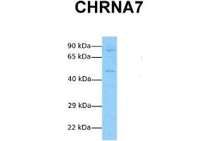 Image no. 3 for anti-Cholinergic Receptor, Nicotinic, alpha 7 (Neuronal) (CHRNA7) (N-Term) antibody (ABIN2792250)